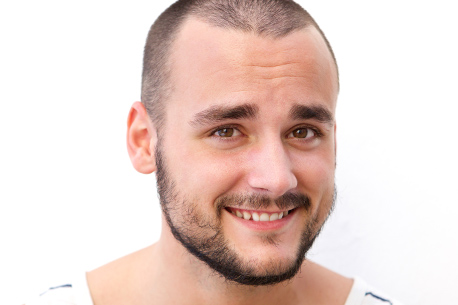 micro Haarpigmentierung - das wundermittel gegen Haarausfall